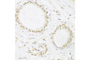 Immunohistochemistry of paraffin-embedded human breast using RBPJ Antibody (ABIN1876876) at dilution of 1:100 (40x lens). (RBPJ antibody)