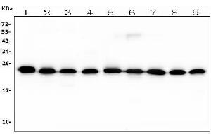 Western blot analysis of RAB11B using anti-RAB11B antibody (ABIN7602766). (RAB11B antibody  (C-Term))