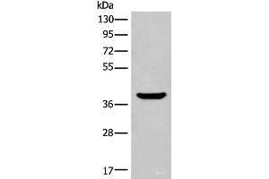 Western blot analysis of Mouse liver tissue lysate using ADORA3 Polyclonal Antibody at dilution of 1:400 (Adenosine A3 Receptor antibody)