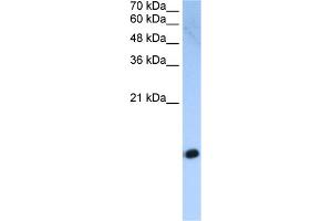 WB Suggested Anti-HIST2H2AC Antibody Titration:  2. (HIST2H2AC antibody  (Middle Region))