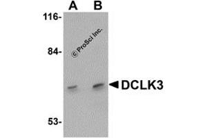 Western Blotting (WB) image for anti-Doublecortin-Like Kinase 3 (DCLK3) (N-Term) antibody (ABIN1031346) (DCLK3 antibody  (N-Term))