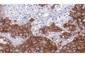 Immunohistochemistry (IHC) image for anti-Bone Morphogenetic Protein Receptor 1A (BMPR1A) (N-Term) antibody (ABIN6260291)