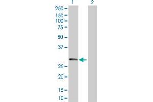 Western Blot analysis of PRSS1 expression in transfected 293T cell line by PRSS1 MaxPab polyclonal antibody.