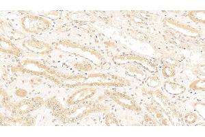 Detection of TDP43 in Human Kidney Tissue using Polyclonal Antibody to Tar DNA Binding Protein 43 kDa (TDP43) (TARDBP antibody  (AA 104-262))