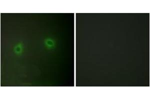 Immunofluorescence analysis of HeLa cells, using Caper Antibody. (RBM39 antibody  (AA 171-220))