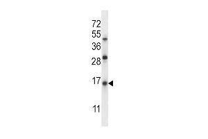 SFTPC Antibody (C-term) (ABIN657607 and ABIN2846604) western blot analysis in Jurkat cell line lysates (35 μg/lane). (Surfactant Protein C antibody  (C-Term))