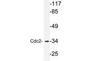 Western blot analyzes of Cdc2 antibody in extracts from HepG2 cells. (CDK1 antibody)