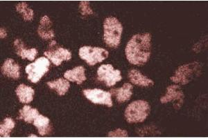 Immunofluorescent staining of A431 cells. (ARNT antibody  (AA 461-574))