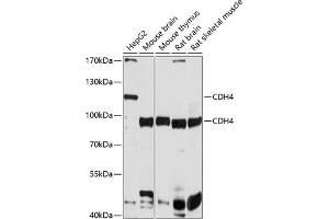 Western blot analysis of extracts of various cell lines, using CDH4 antibody (ABIN6129232, ABIN6138295, ABIN6138296 and ABIN6214850) at 1:1000 dilution. (Cadherin 4 antibody  (AA 757-916))