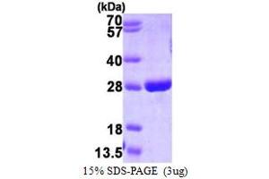SDS-PAGE (SDS) image for Glutathione S-Transferase pi 1 (GSTP1) (AA 1-210) protein (His tag) (ABIN666776) (GSTP1 Protein (AA 1-210) (His tag))