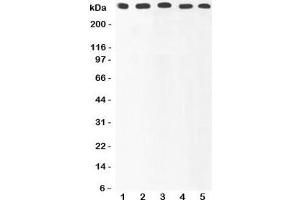 Western blot testing of Ki67 antibody and Lane 1:  HeLa;  2: MCF-7;  3: COLO320;  4: HEPG2;  5: SKOV lysate. (Ki-67 antibody  (AA 2860-3256))