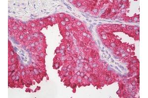 Anti-IL-27 antibody IHC of human prostate. (IL-27 antibody  (C-Term))