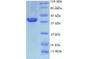 SDS-PAGE (SDS) image for PHD Finger Protein 5A (PHF5A) (AA 1-110), (full length) protein (GST tag) (ABIN4974325)