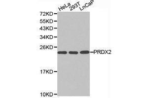 Western Blotting (WB) image for anti-Peroxiredoxin 2 (PRDX2) antibody (ABIN1874253)