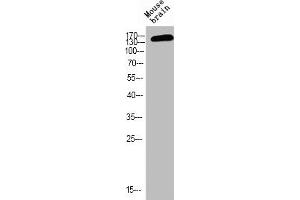 Western blot analysis of MOUSE-BRAIN using p-NMDAε2 (Y1474) antibody. (GRIN2B antibody  (pTyr1474))