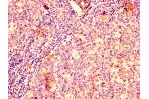 IHC image of ABIN7145433 diluted at 1:500 and staining in paraffin-embedded human tonsil tissue performed on a Leica BondTM system. (GRK2 antibody  (AA 2-221))