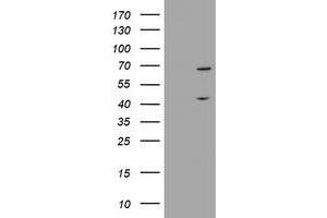 Image no. 1 for anti-Methyltransferase Like 16 (METTL16) antibody (ABIN1499433) (METTL16 antibody)