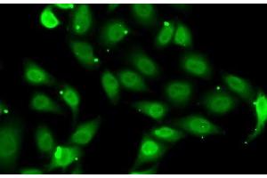 Immunofluorescence analysis of MCF7 cells using TEAD1 Polyclonal Antibody
