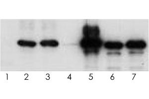 Western blot analysis of human tau (2N4R) using various antisera. (tau antibody  (Isoform 6, pTyr18))