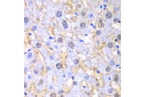 Immunohistochemistry of paraffin-embedded human liver injury using FAH antibody. (FAH antibody  (AA 1-419))