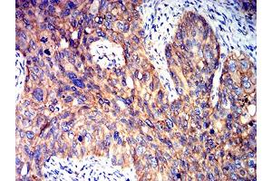 Immunohistochemistry (IHC) image for anti-Protein Kinase, AMP-Activated, beta 2 Non-Catalytic Subunit (PRKAB2) (AA 1-120) antibody (ABIN5611226)