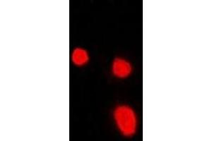 Immunofluorescent analysis of Malin staining in Hela cells. (NHLRC1 antibody)