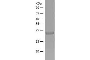 Western Blotting (WB) image for Insulin-Like Growth Factor Binding Protein 6 (IGFBP6) (AA 28-240) protein (His tag) (ABIN7123464) (IGFBP6 Protein (AA 28-240) (His tag))