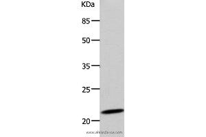 Western blot analysis of 293T cell, using DUT Polyclonal Antibody at dilution of 1:500 (Deoxyuridine Triphosphatase (DUT) antibody)
