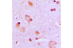 Immunohistochemical analysis of CEP57 staining in human brain formalin fixed paraffin embedded tissue section. (CEP57 antibody  (Center))