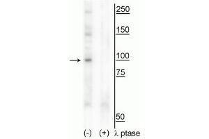 Western blot of human T47D cell lysate showing specific immunolabeling of the ~100 kDa CtIP phosphorylated at Thr847 in the first lane (-). (Retinoblastoma Binding Protein 8 antibody  (pThr847))