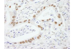 anti-Splicing Factor 3b, Subunit 2, 145kDa (SF3B2) (AA 775-825) antibody