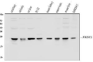 Western blot analysis of Peroxiredoxin 1 using anti-Peroxiredoxin 1 antibody (ABIN3043903). (Peroxiredoxin 1 antibody  (Middle Region))