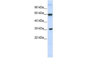 Western Blotting (WB) image for anti-C-Type Lectin Domain Family 4, Member M (CLEC4M) antibody (ABIN2458650) (C-Type Lectin Domain Family 4, Member M (CLEC4M) antibody)