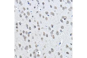 Immunohistochemistry of paraffin-embedded mouse brain using MonoMethyl-Histone H3-K27 Rabbit pAb (ABIN3023262, ABIN3023263, ABIN3023264, ABIN1513004 and ABIN6219518) at dilution of 1:100 (40x lens). (Histone 3 antibody  (H3K27me1))