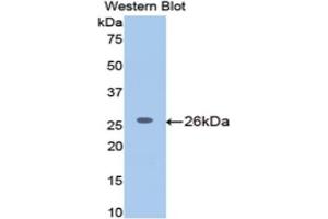 Western blot analysis of the recombinant protein. (MGEA5 antibody  (AA 19-222))
