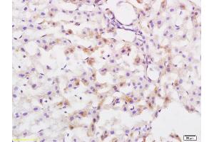 Formalin-fixed and paraffin embedded rat liver tissue labeled with Anti Protective Protein Polyclonal Antibody, Unconjugated  at 1:200 followed by conjugation to the secondary antibody and DAB staining (CTSA antibody  (AA 401-480))