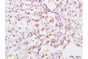 Formalin-fixed and paraffin embedded rat liver tissue labeled with Anti Protective Protein Polyclonal Antibody, Unconjugated  at 1:200 followed by conjugation to the secondary antibody and DAB staining (CTSA antibody  (AA 401-480))