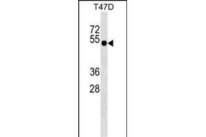 GLI4 Antibody (N-term) (ABIN1539446 and ABIN2849209) western blot analysis in T47D cell line lysates (35 μg/lane).