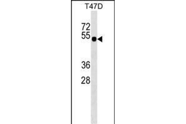 GLI4 Antikörper  (N-Term)