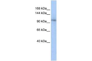 WB Suggested Anti-TCERG1 Antibody Titration:  0. (TCERG1 antibody  (Middle Region))