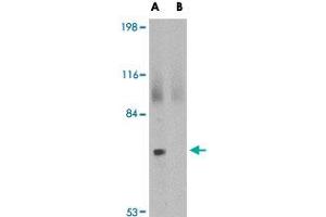 Western blot analysis of JPH2 in 293 cell lysate with JPH2 polyclonal antibody  at 2 ug/mL in (A) the absence and (B) the presence of blocking peptide.
