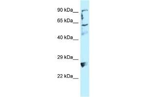 WB Suggested Anti-LIMA1 Antibody Titration: 1. (LIMA1 antibody  (C-Term))
