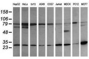 Image no. 4 for anti-RAB21, Member RAS Oncogene Family (RAB21) antibody (ABIN1500545) (RAB21 antibody)