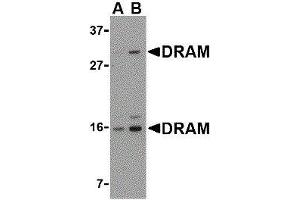 Western Blotting (WB) image for anti-DNA-Damage Regulated Autophagy Modulator 1 (DRAM1) (C-Term) antibody (ABIN2473364)