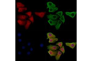 Phospho-SNAIL (Ser11) Antibody staining Hela cells(heat shock treatment) by IF/ICC.