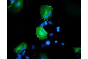 Anti-CCM2 mouse monoclonal antibody (ABIN2454939) immunofluorescent staining of COS7 cells transiently transfected by pCMV6-ENTRY CCM2 (RC201418). (CCM2 antibody)