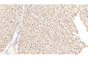 Detection of KMO in Human Liver Tissue using Polyclonal Antibody to Kynurenine-3-Monooxygenase (KMO) (KMO antibody  (AA 1-374))