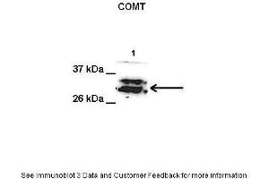 Lanes:   1. (COMT antibody  (Middle Region))