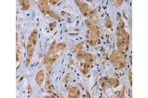 Immunohistochemistry (IHC) image for anti-C-Type Lectin Domain Family 1, Member A (CLEC1A) antibody (ABIN2427969) (CLEC1A antibody)