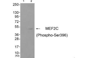 Western blot analysis of extracts from cos-7 cells (Lane 2), using MEF2C (Phospho-Ser396) Antibody.